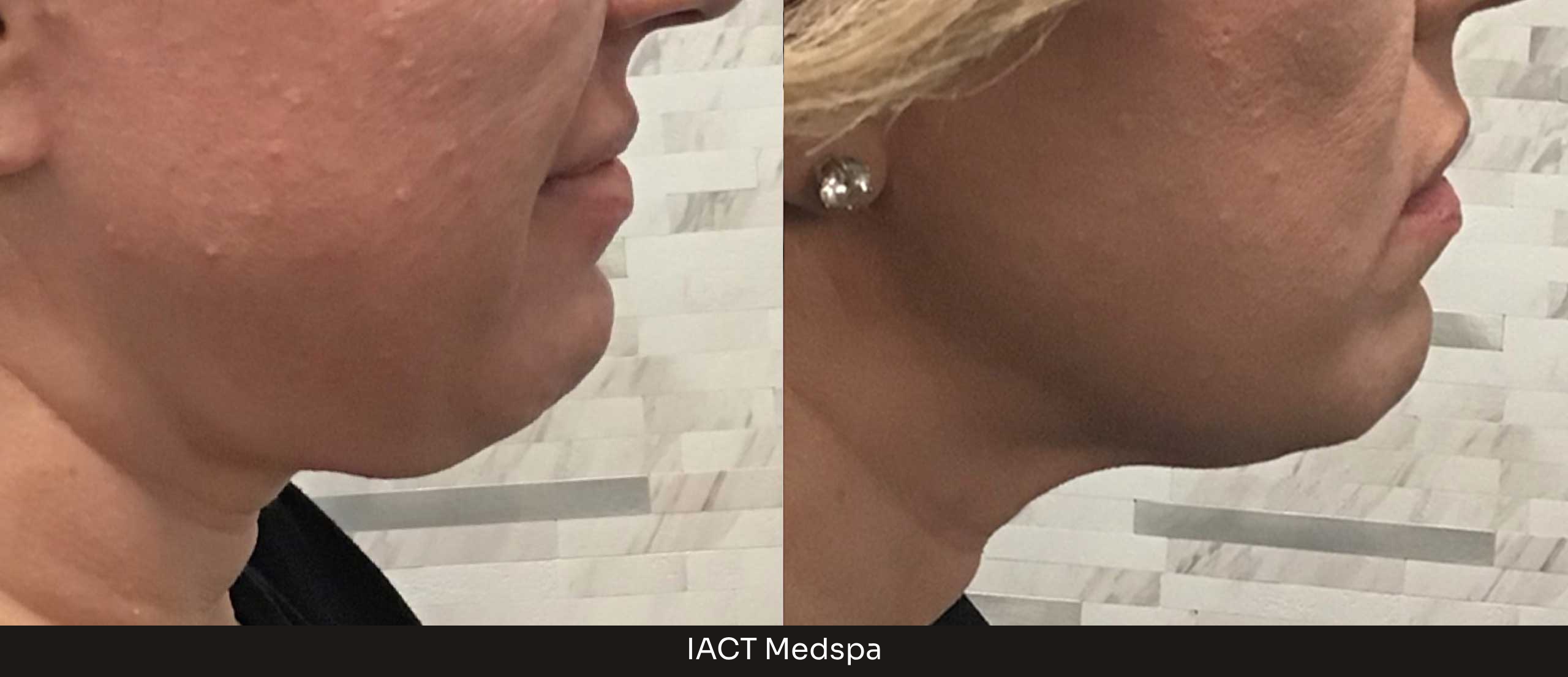 Define Facial Modeling